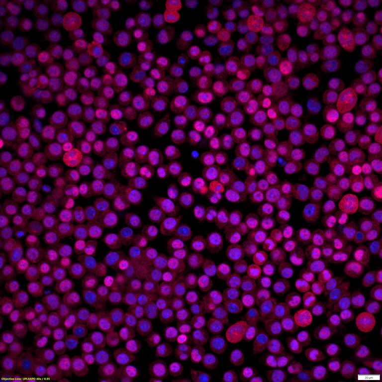 Ankyron TNF11_MOUSE Clone AS40678