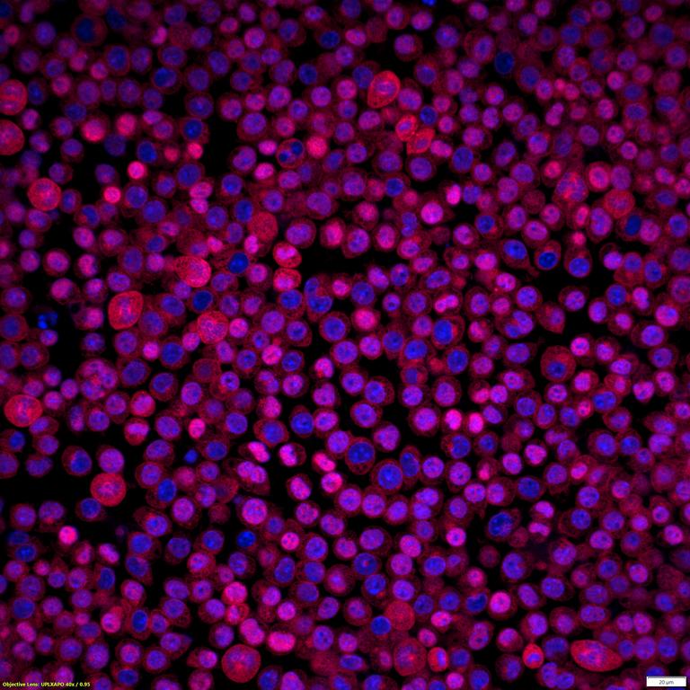 Ankyron TNF11_MOUSE Clone AS40671