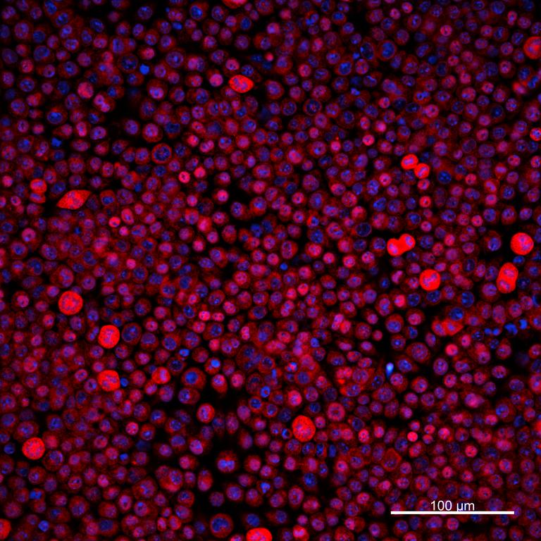 Ankyron TNF11_MOUSE Clone AS40664