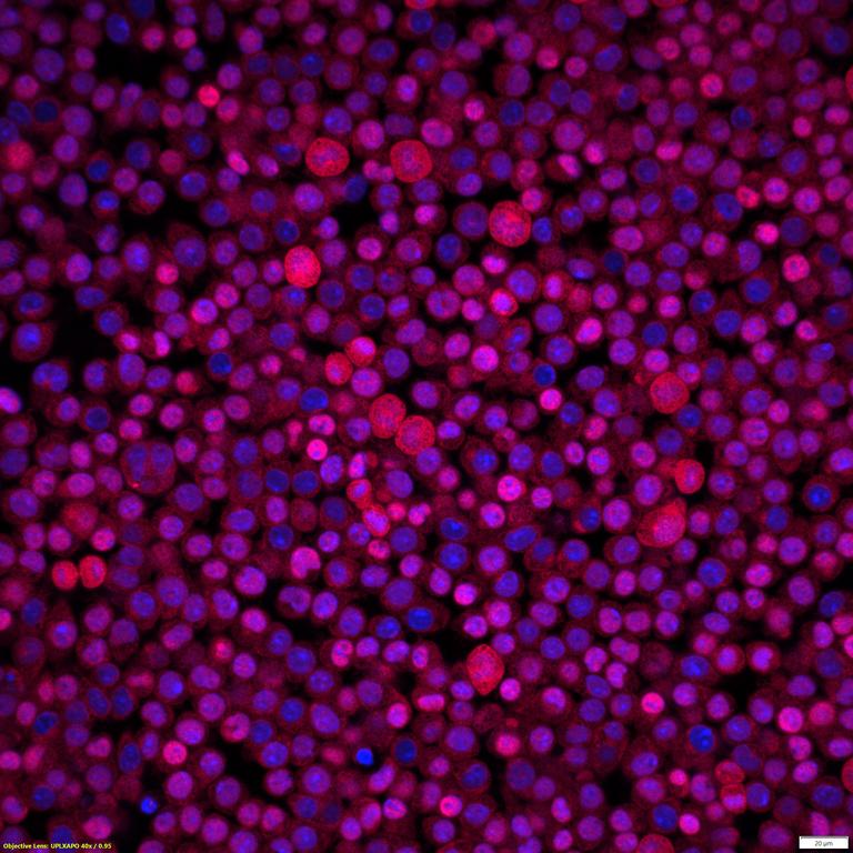 Ankyron TNF13_MOUSE Clone DN41155