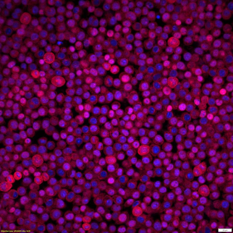 Ankyron TNF13_MOUSE Clone DN41163