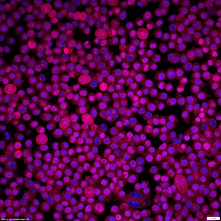 Ankyron TNF13_MOUSE Clone DN41156