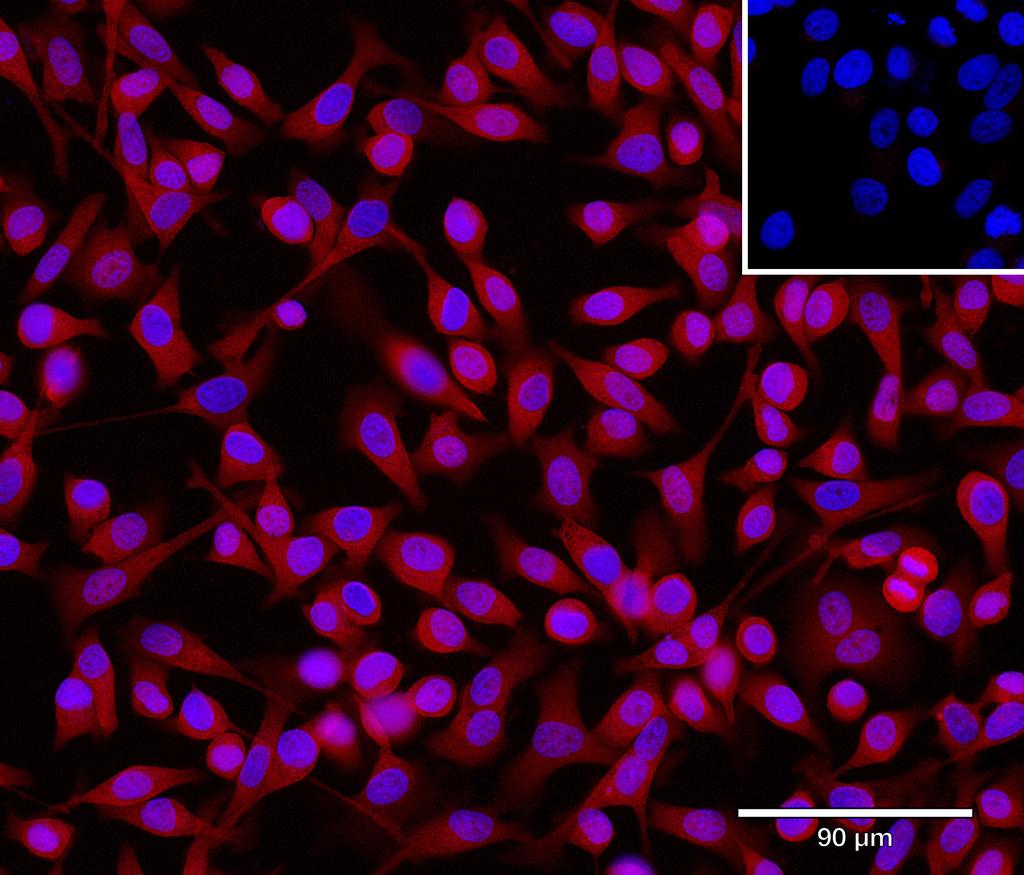 Ankyron TNF14_HUMAN Clone AC40586
