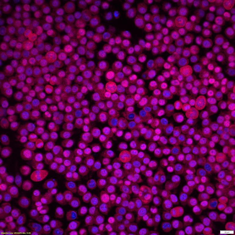 Ankyron TNF14_MOUSE Clone FE40912