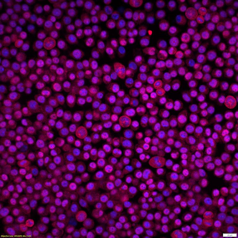Ankyron TNF14_MOUSE Clone FE40924