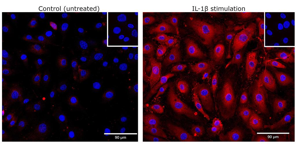 Ankyron TNFA_HUMAN Clone AB40606