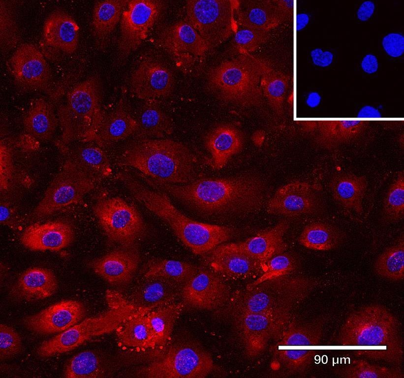 Ankyron TNFA_HUMAN Clone AB40610