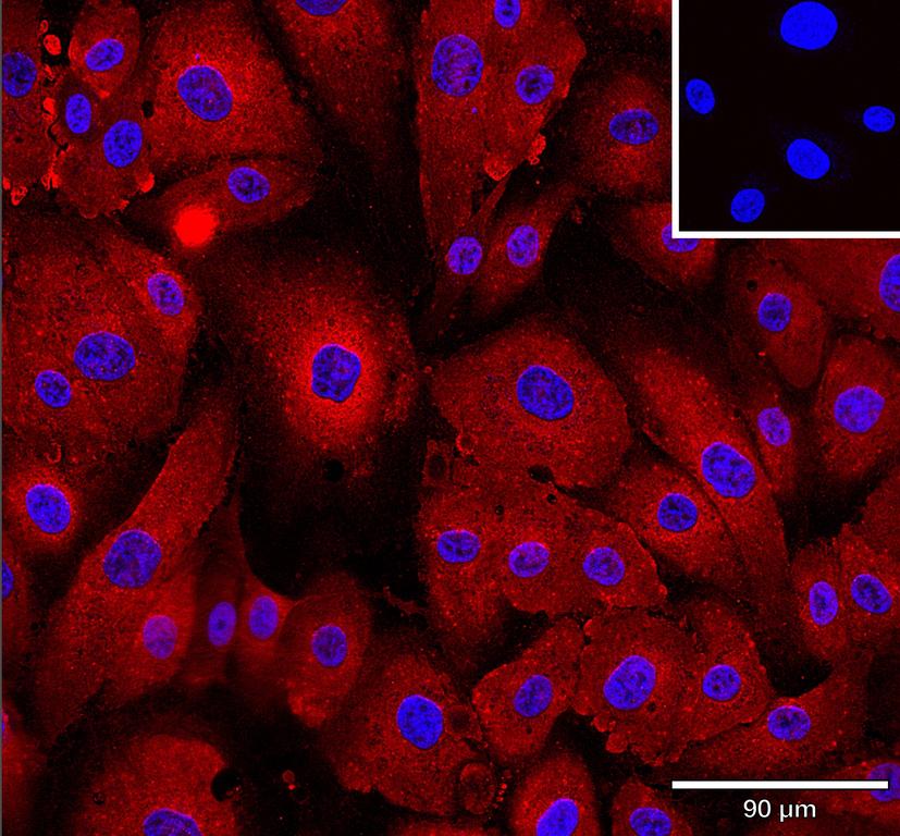 Ankyron TNFA_HUMAN Clone AB40605