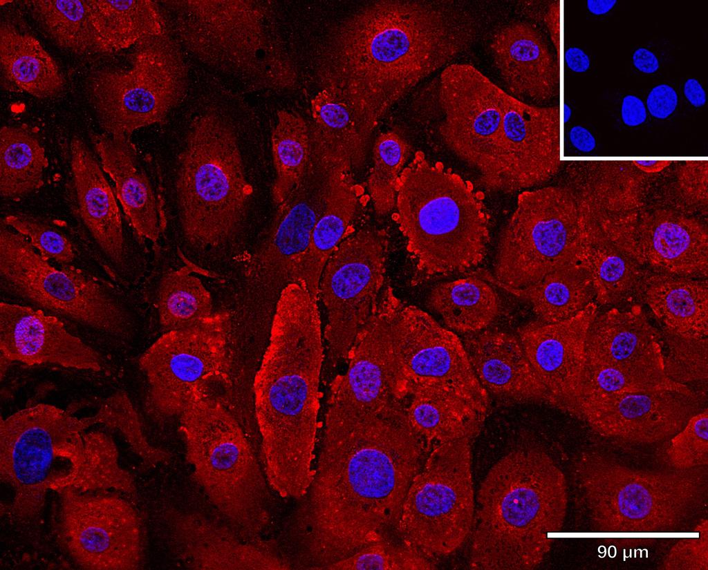 Ankyron TNFA_HUMAN Clone AB40609