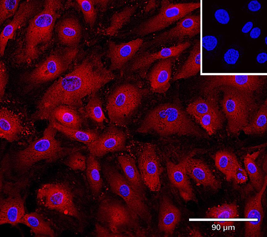 Ankyron TNFA_HUMAN Clone AB40607