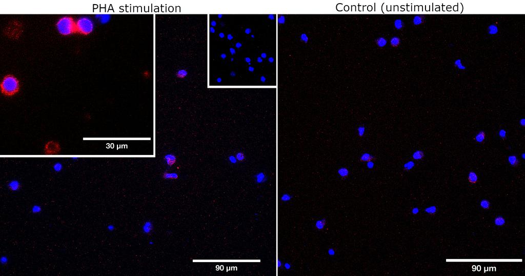 Ankyron TNR18_HUMAN Clone CB30287