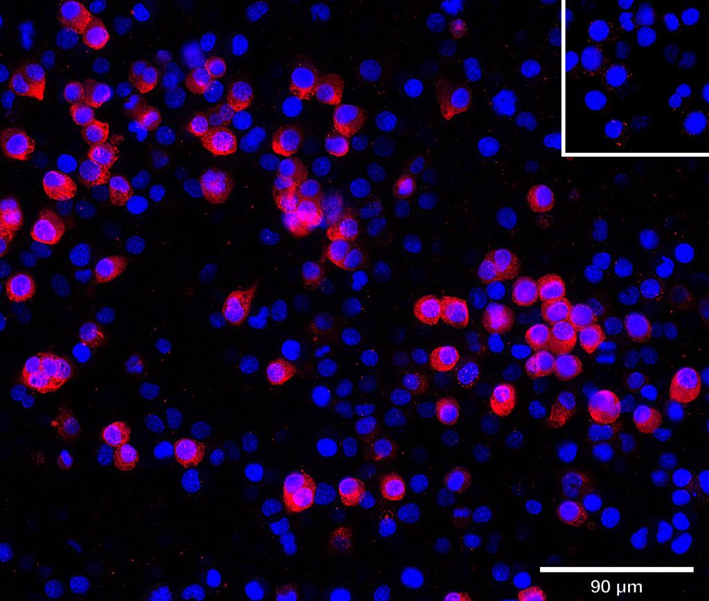 Ankyron TNR18_MOUSE Clone AS40119