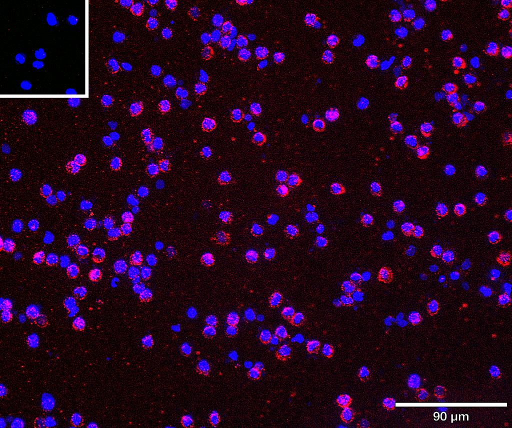 Ankyron TNR1B_HUMAN Clone AB40709