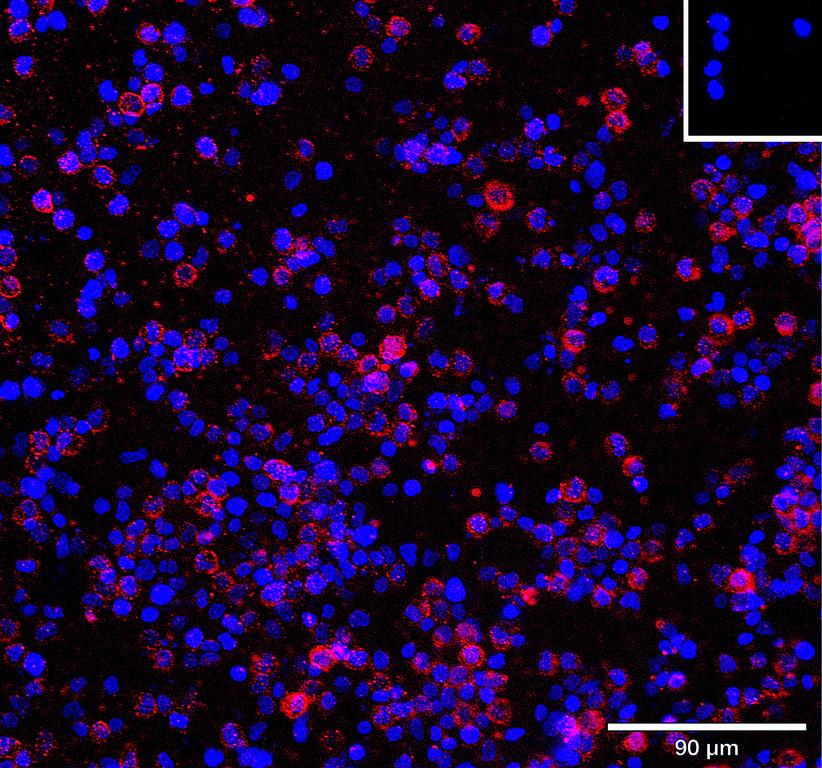 Ankyron TNR1B_HUMAN Clone AB40706