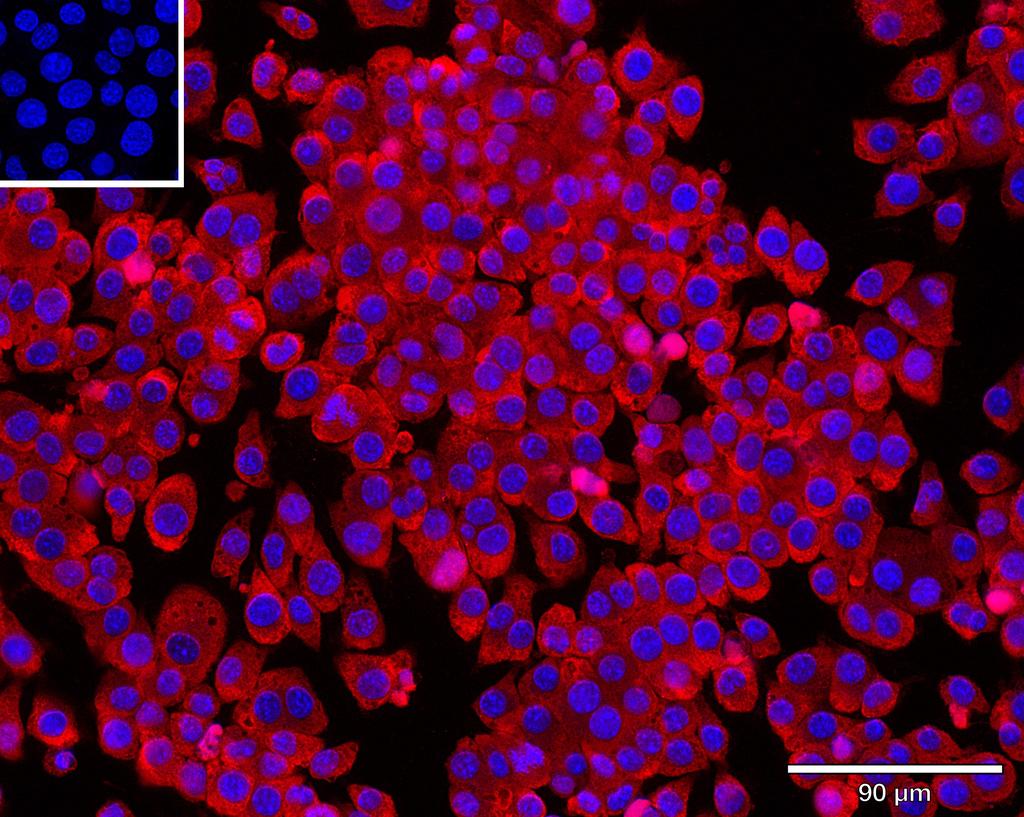 Ankyron TNR1B_MOUSE Clone BS41225