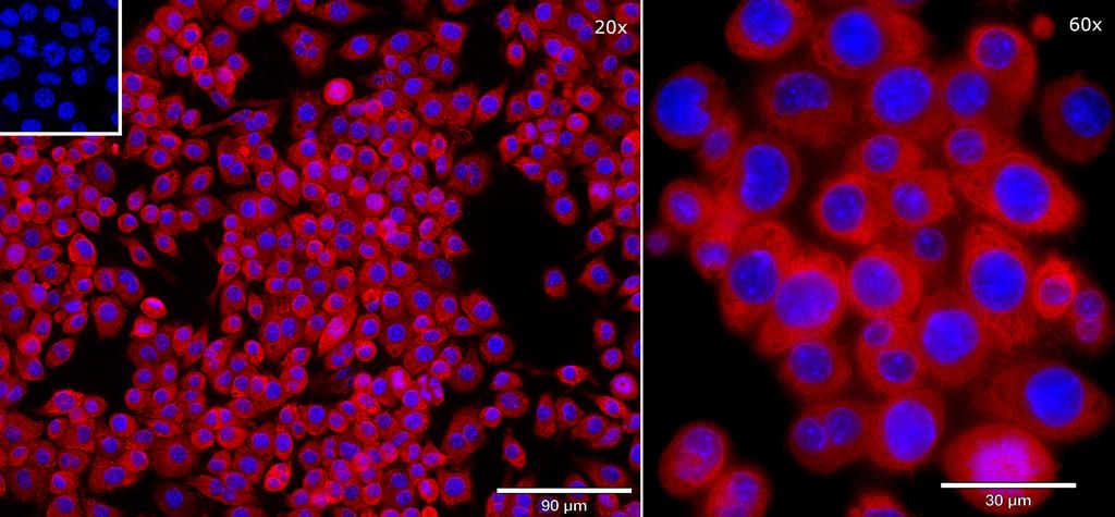 Ankyron TNR1B_MOUSE Clone BS41235