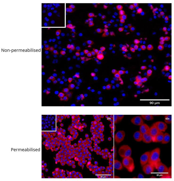 Ankyron TNR1B_MOUSE Clone BS41240