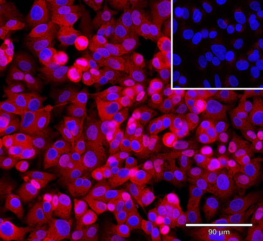 Ankyron TNR21_HUMAN Clone CN40246