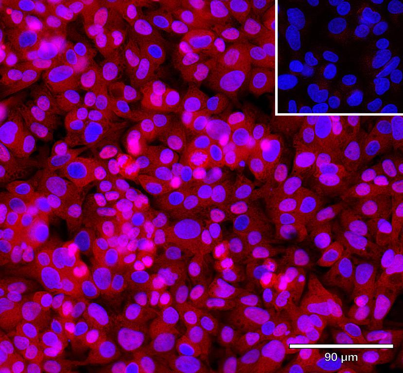 Ankyron TNR21_HUMAN Clone CN40245