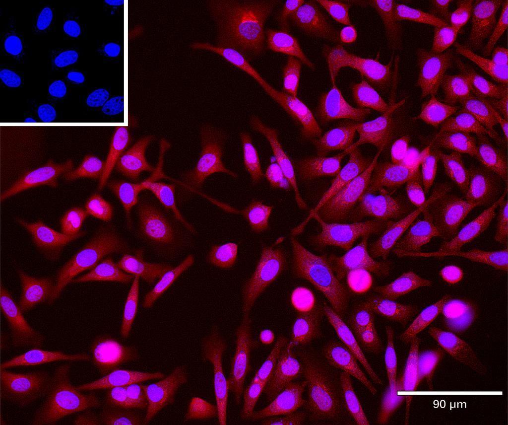 Ankyron TNR27_HUMAN Clone CL40432