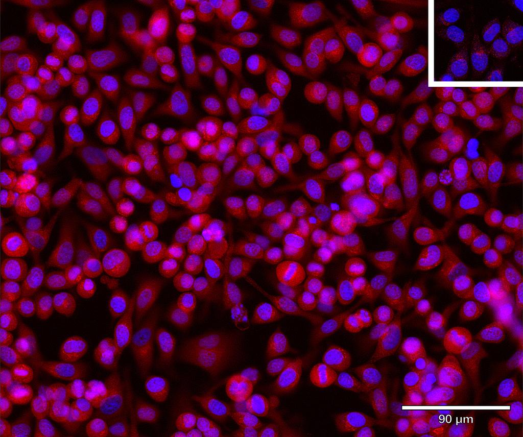Ankyron TNR27_HUMAN Clone CL40429