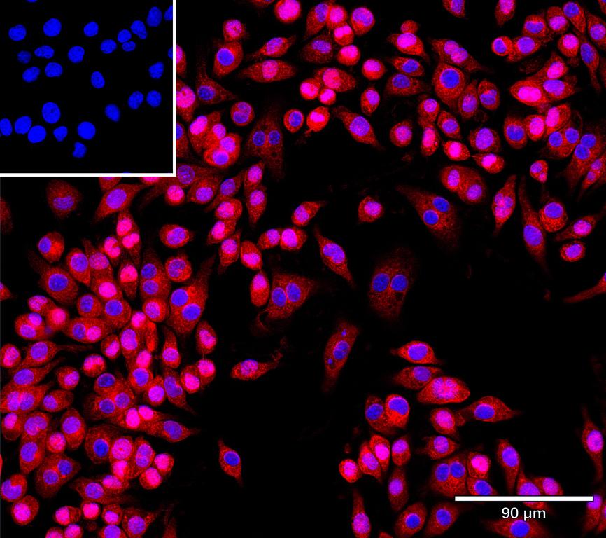 Ankyron TPP1_MOUSE Clone AT40242