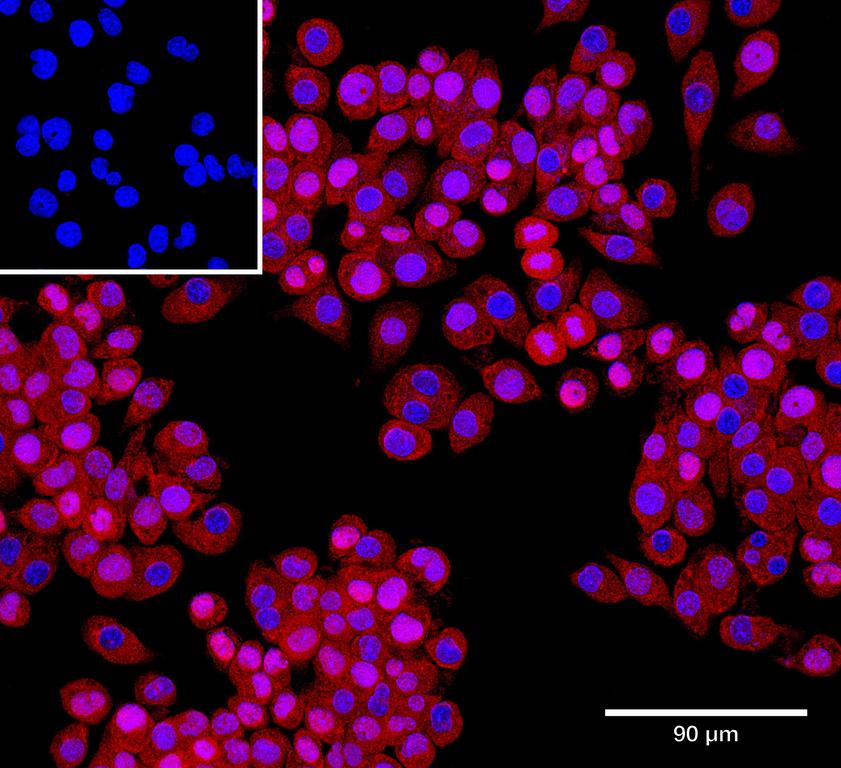 Ankyron TPP1_MOUSE Clone AT40243
