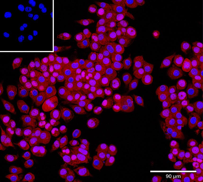 Ankyron TPP1_MOUSE Clone AT40244