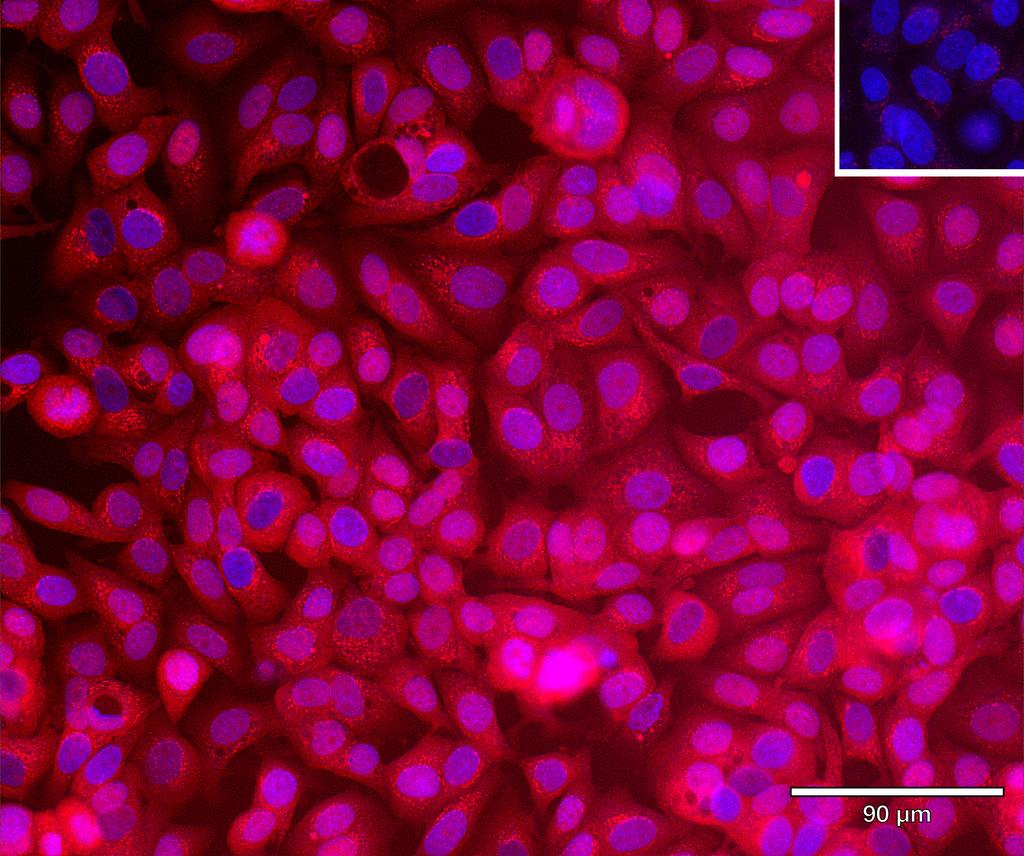 Ankyron TR11B_HUMAN Clone AE40142