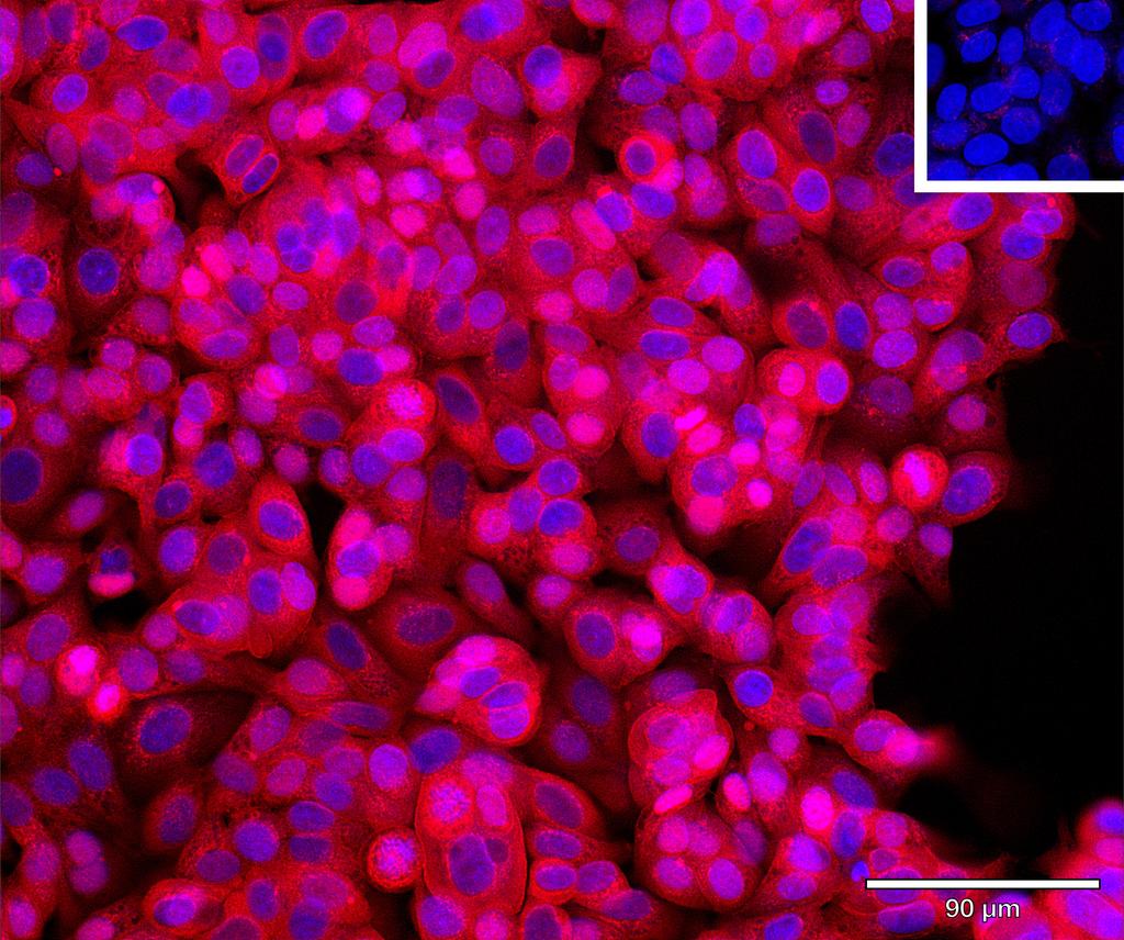Ankyron TR11B_HUMAN Clone AE40144