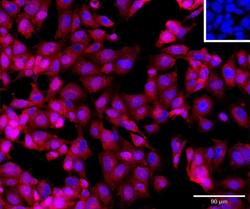 Ankyron TR19L_HUMAN Clone DI40208