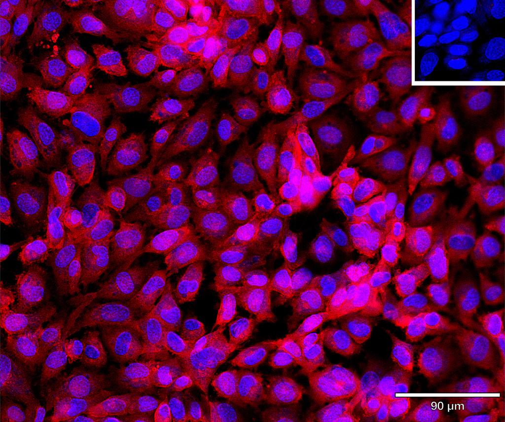 Ankyron TR19L_HUMAN Clone DI40210