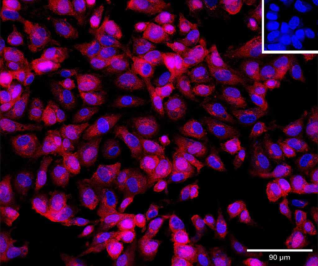 Ankyron TR19L_HUMAN Clone DI40214