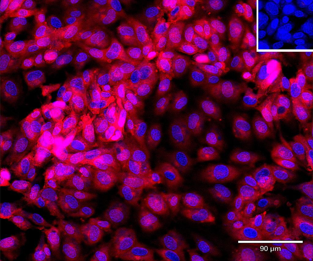 Ankyron TR19L_HUMAN Clone DI40219