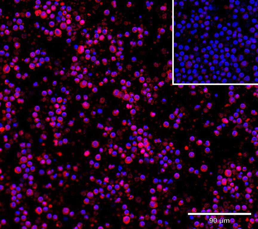 Ankyron TRML1_HUMAN Clone BY30411
