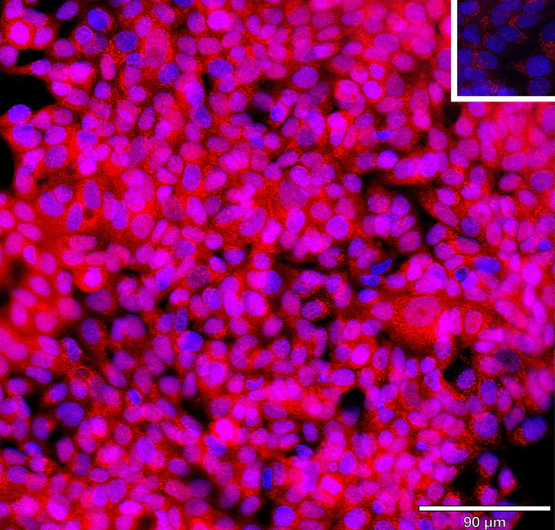 Ankyron TXNIP_HUMAN Clone BZ30842