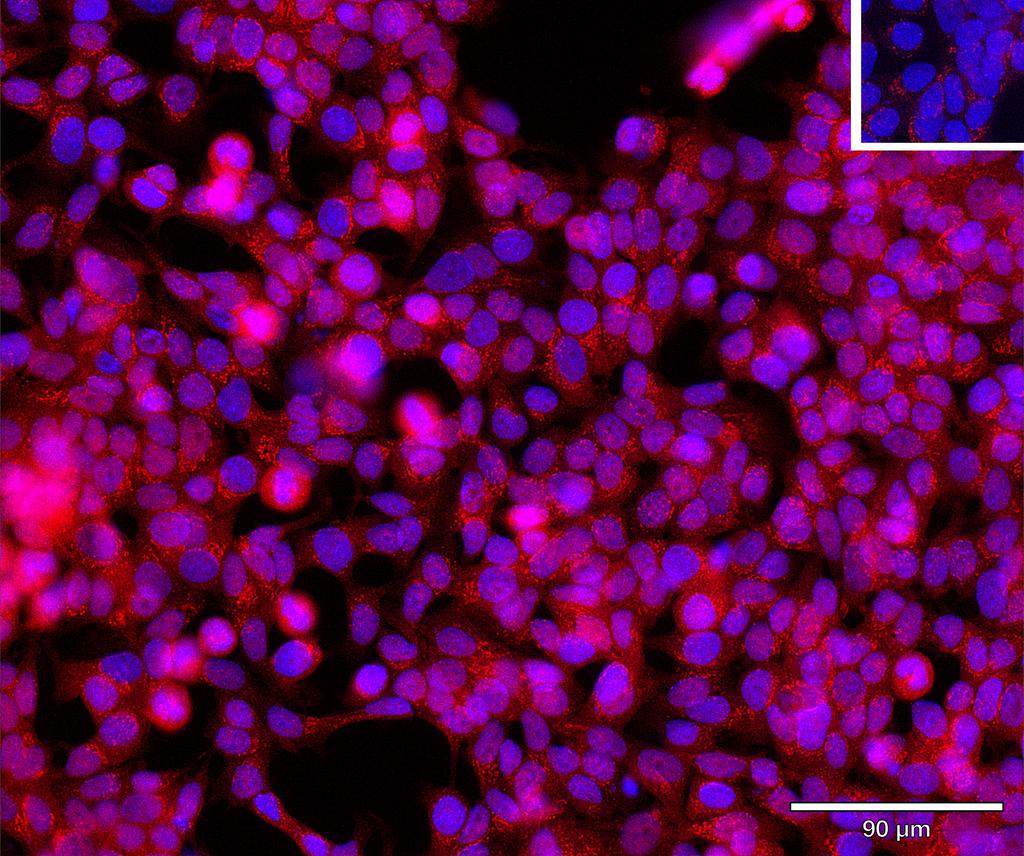 Ankyron TXNIP_HUMAN Clone BZ30850