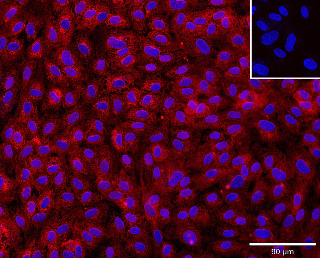 Ankyron UBAC1_HUMAN Clone BM30104