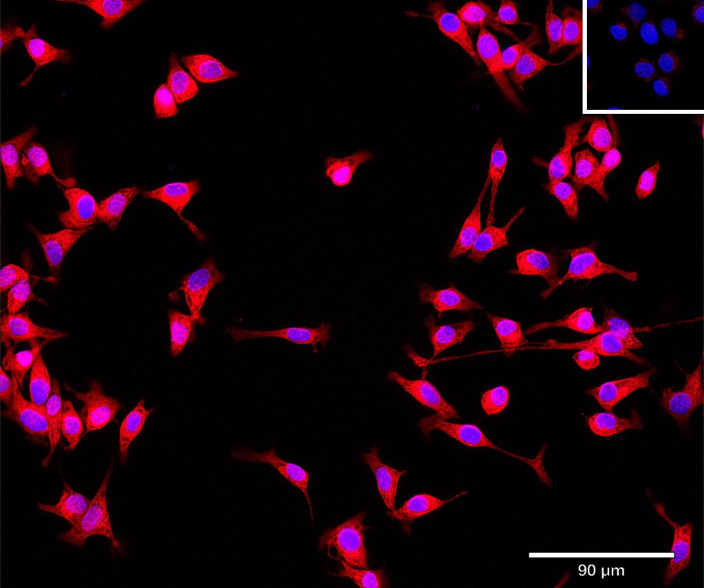 Ankyron UBE2H_HUMAN Clone BA40841