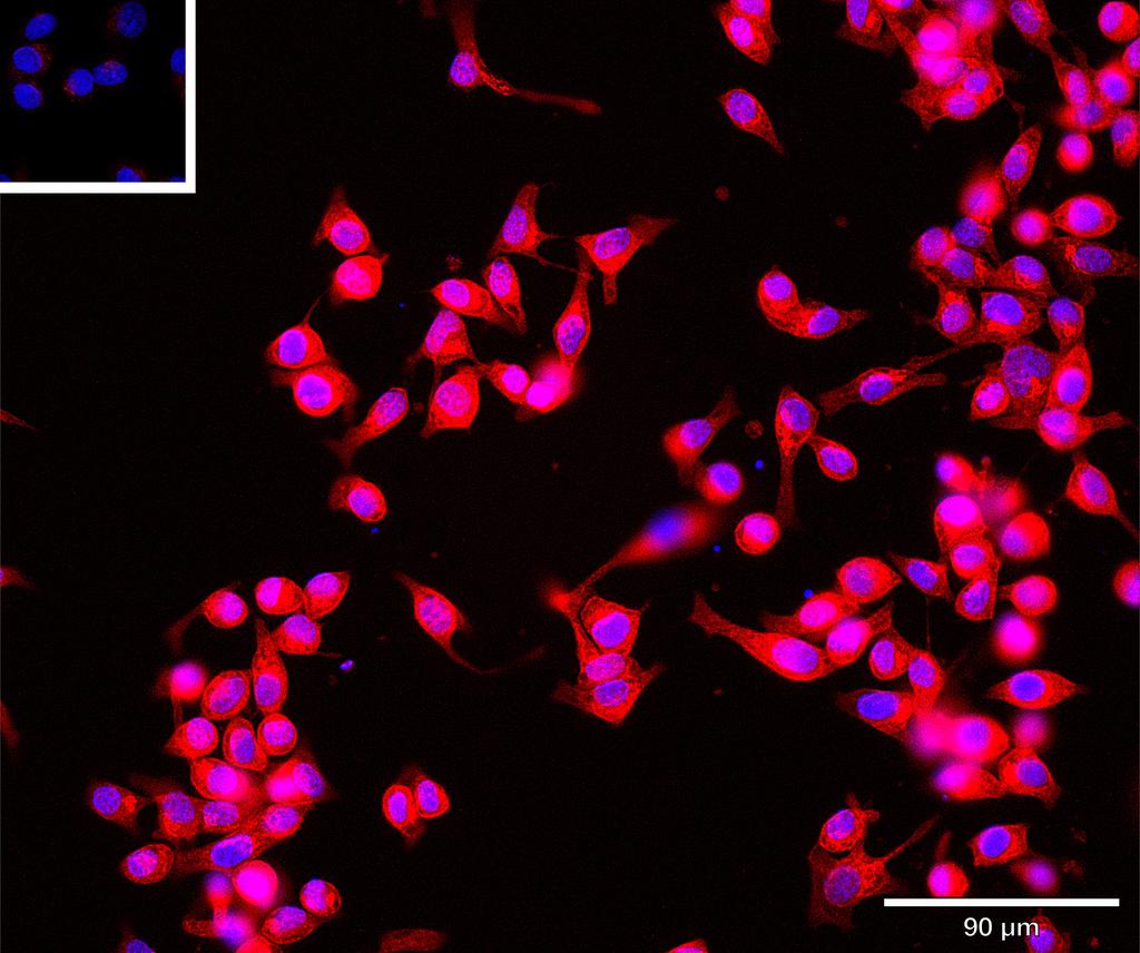 Ankyron UBE2H_HUMAN Clone BA40842