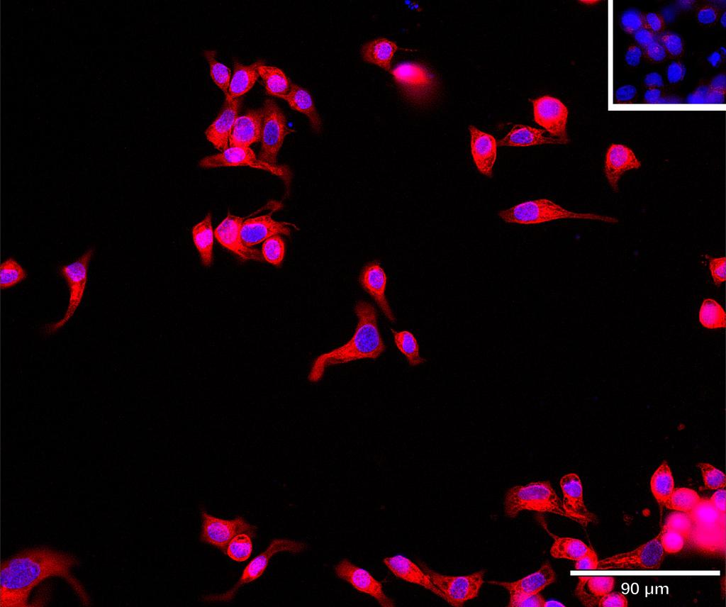 Ankyron UBE2H_HUMAN Clone BA40843
