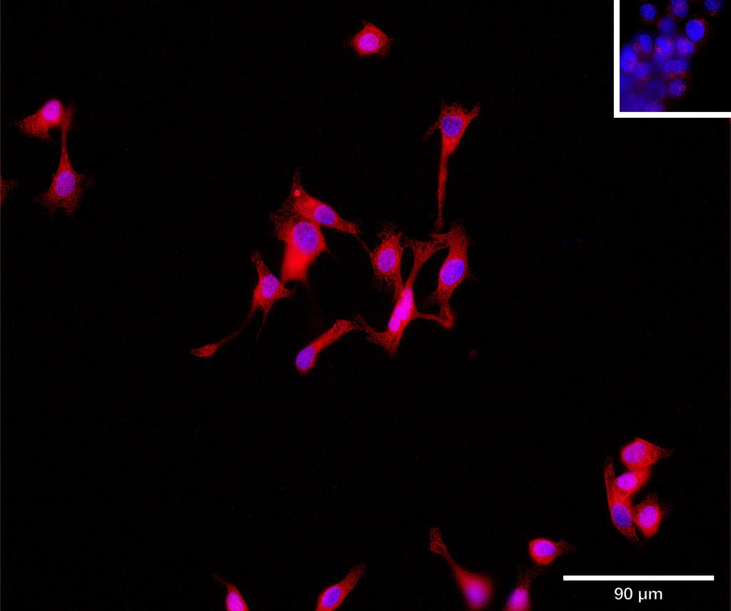 Ankyron UBE2H_HUMAN Clone BA40845