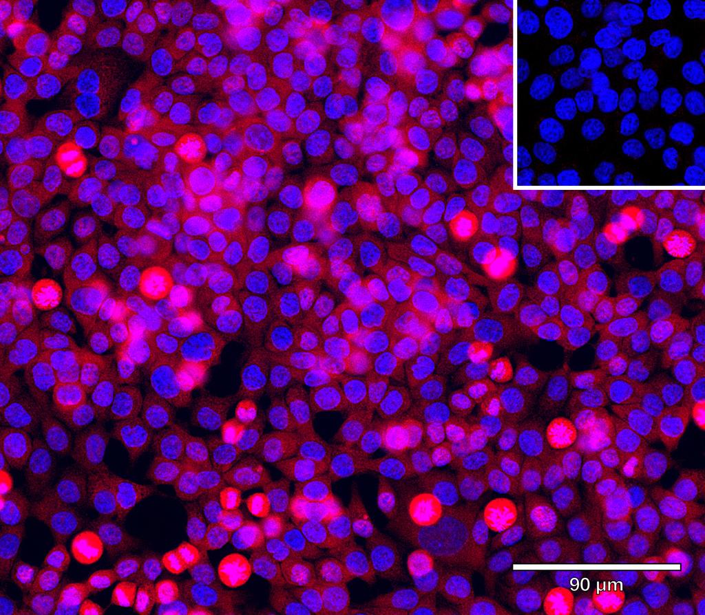 Ankyron ULBP2_HUMAN Clone BS40162
