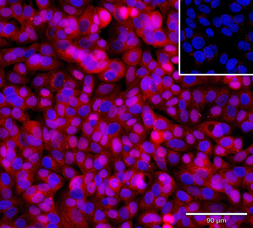 Ankyron ULBP6_HUMAN Clone EC30446