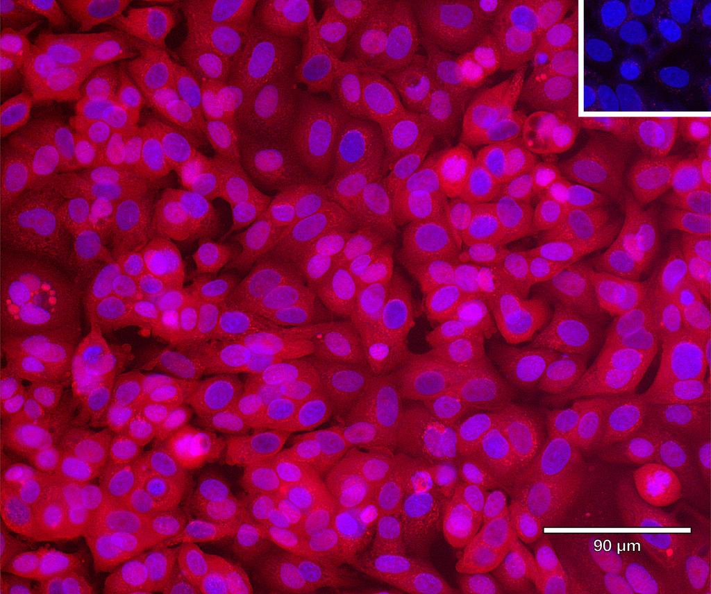 Ankyron ULBP6_HUMAN Clone EC30444
