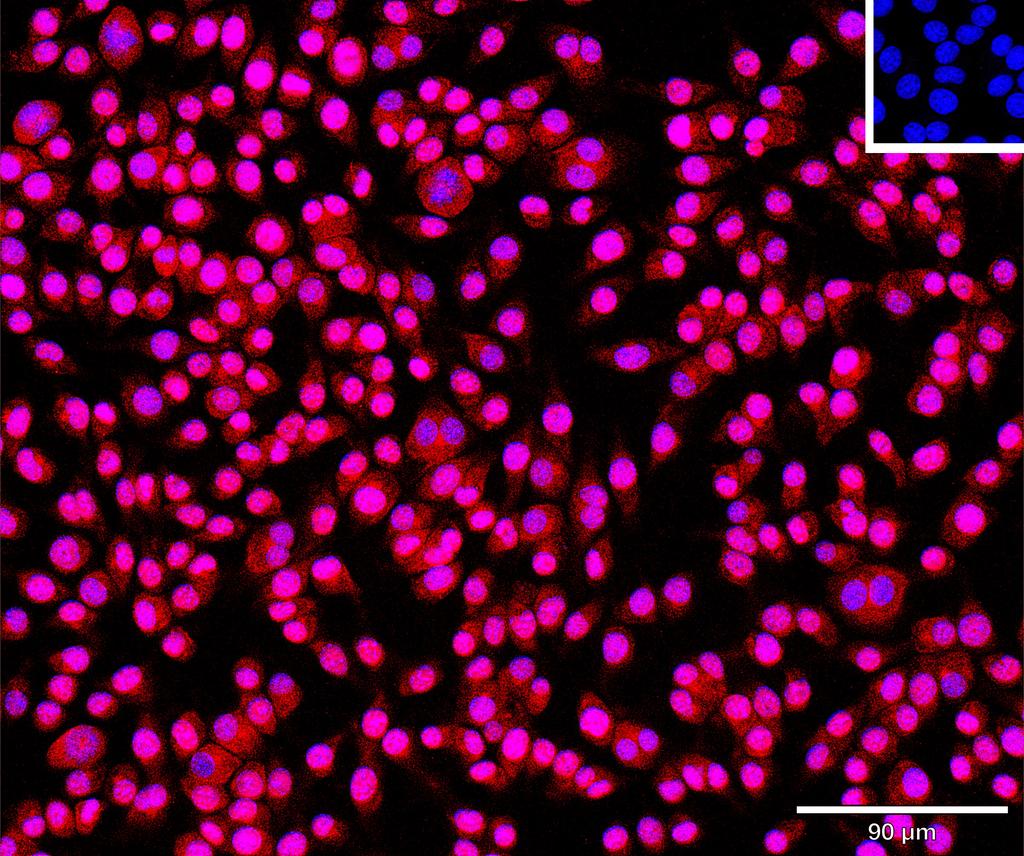 Ankyron UROK_MOUSE Clone BP40334