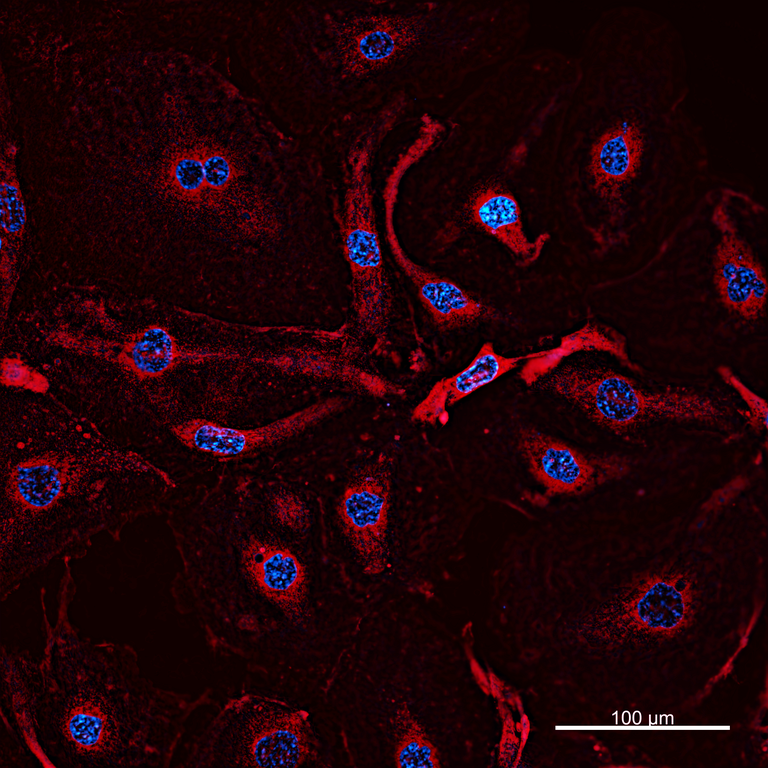 Ankyron VEGFA_HUMAN Clone BA41021