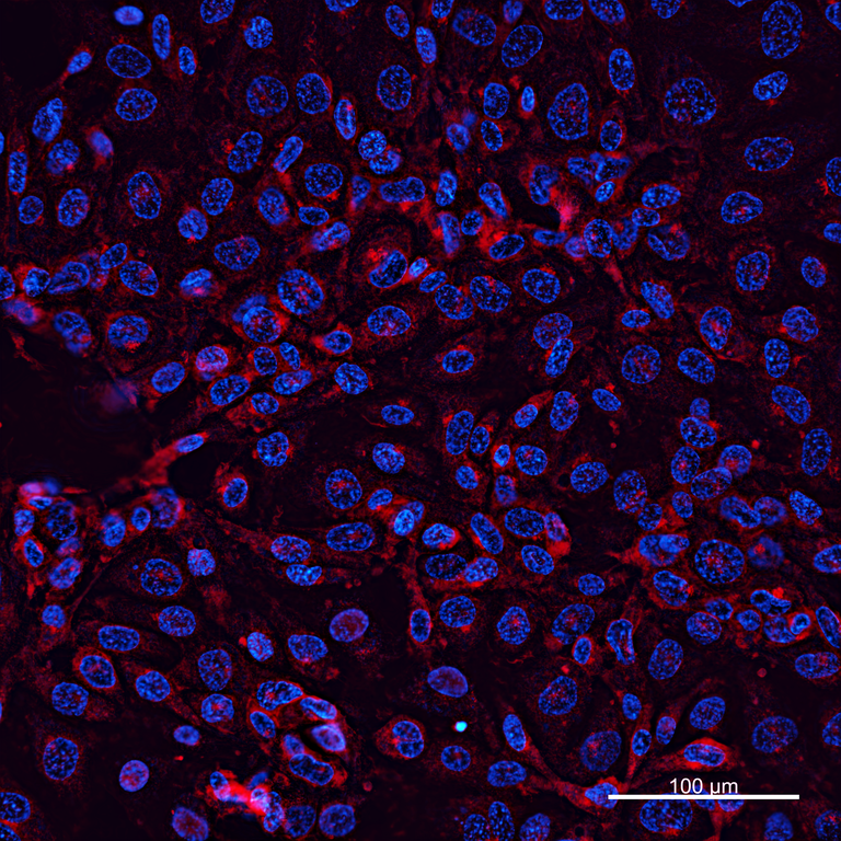 Ankyron VEGFA_HUMAN Clone AB40383