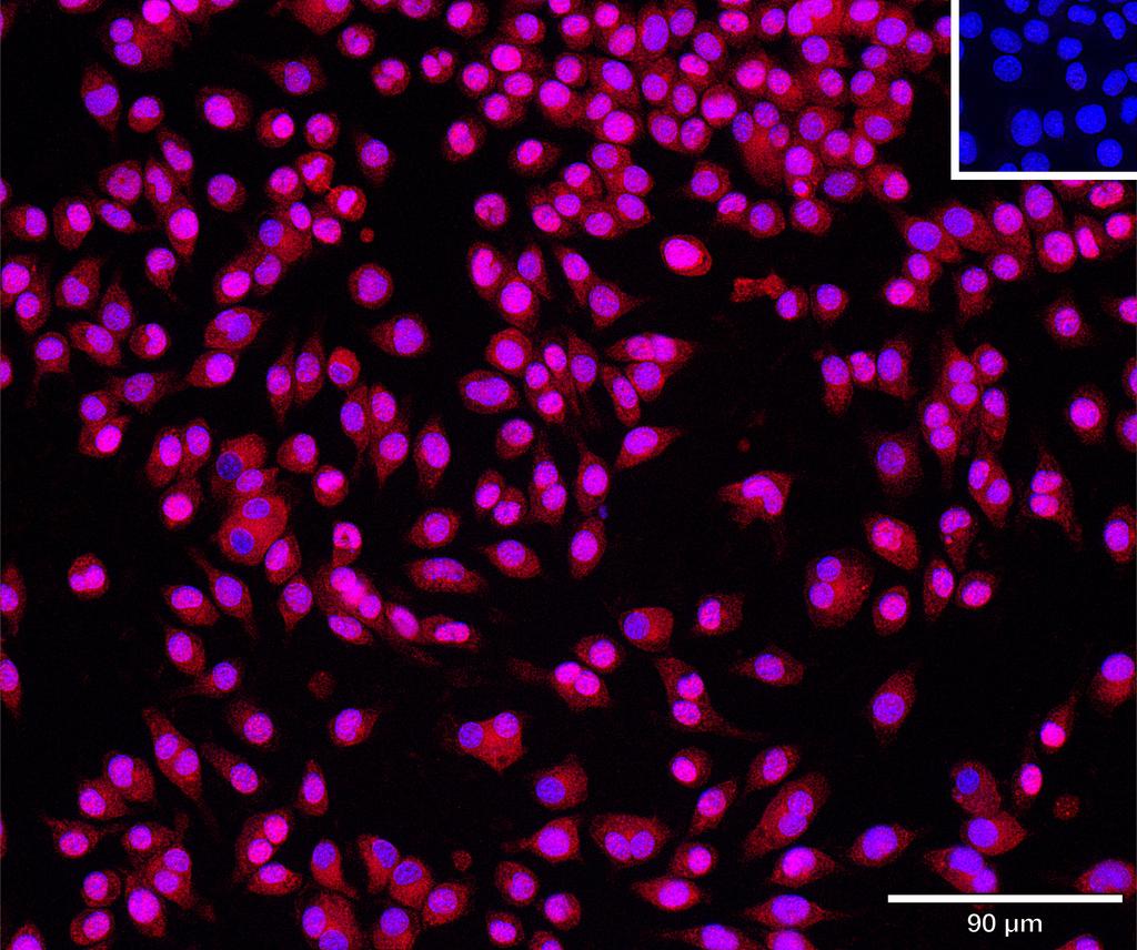 Ankyron VTCN1_MOUSE Clone AR40347