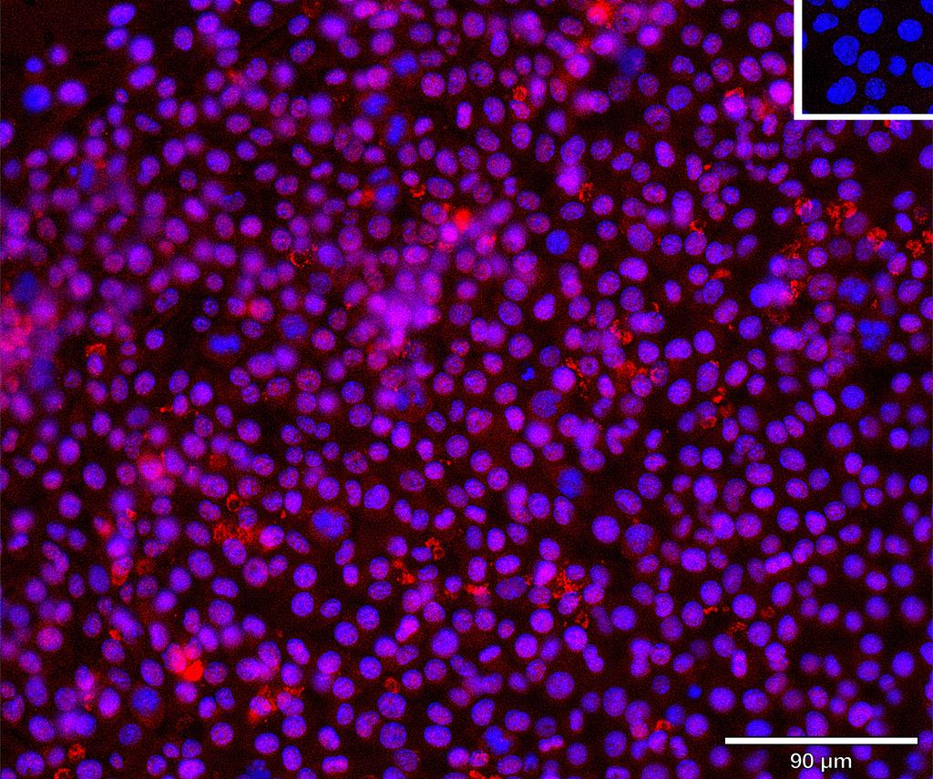 Ankyron VTNC_MOUSE Clone DJ41079